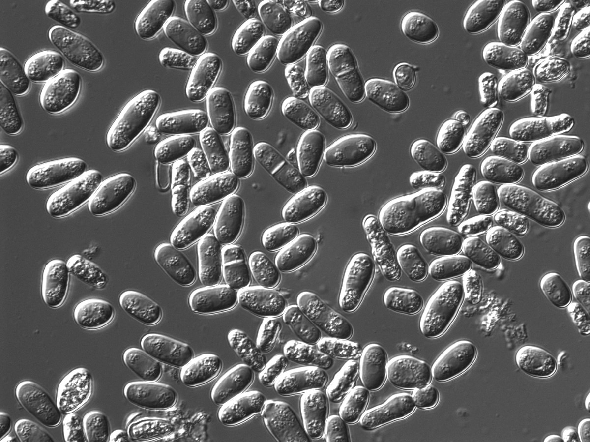 Figure 17.9. Yeast Cells